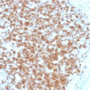 IHC of human lymph node stained with CD22 Mouse Monoclonal Antibody AE00160