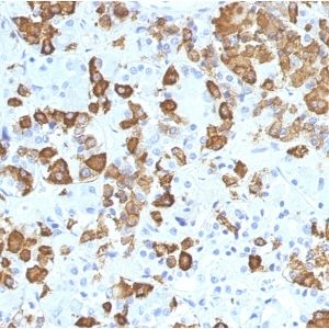 IHC of human anterior pituitary stained with GH1 Mouse Monoclonal Antibody AE00179