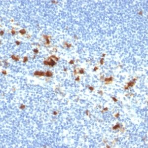 IHC of human tonsil stained with CD103 Mouse Monoclonal Antibody AE00183