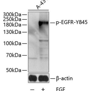 WB of A431 stained with EGFR-pY845 Rabbit Phospho-Specific Polyclonal Antibody AE00212