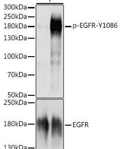 WB of A431 stained with EGFR-pY1086 Rabbit Phospho-Specific Polyclonal Antibody AE00216