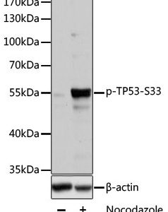 WB of HT29 stained with TP53-pS33 Rabbit Phospho-Specific Polyclonal Antibody AE00220