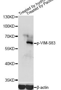 WB of HeLa stained with VIM-pS83 Rabbit Phospho-Specific Polyclonal Antibody AE00238