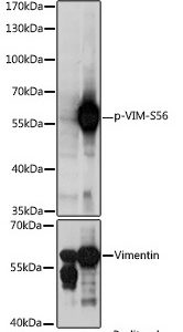 WB of HeLa stained with VIM-pS56 Rabbit Phospho-Specific Polyclonal Antibody AE00239