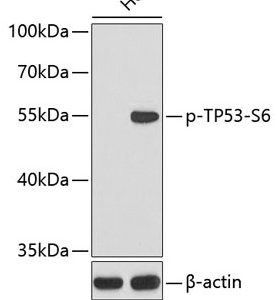 WB of HeLa stained with TP53-pS6 Rabbit Phospho-Specific Polyclonal Antibody AE00222