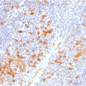 IHC of human tonsil stained with CD123 Rabbit Recombinant Monoclonal Antibody AE00251