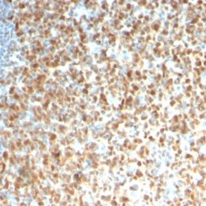 IHC of human tonsil stained with MCM7 Mouse Recombinant Monoclonal Antibody AE00255