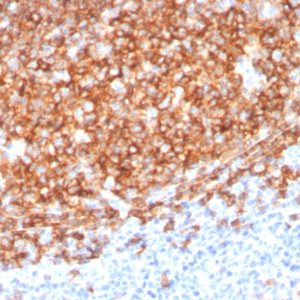 IHC of human tonsil stained with CD20 Mouse Monoclonal Antibody AE00261
