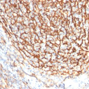 IHC of human tonsil stained with CD21 Mouse Monoclonal Antibody AE00269