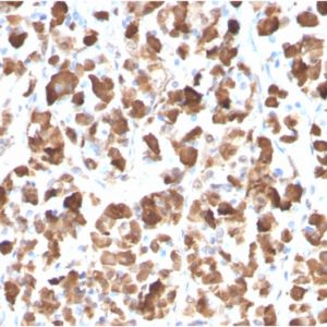 IHC of human pituitary gland stained with GH1 Mouse Monoclonal Antibody AE00275
