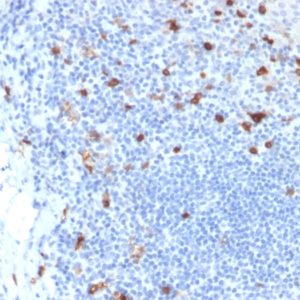 IHC of human tonsil stained with CD103 Mouse Monoclonal Antibody AE00277