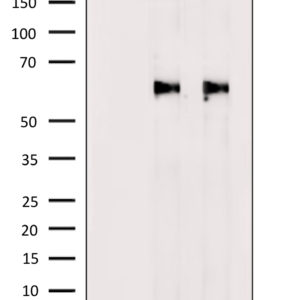 WB of cell line C6 stained with AKT124-pS Rabbit Polyclonal Antibody AE00296