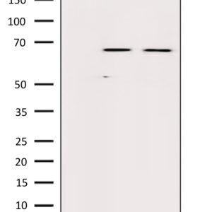 WB of PMA-treated cell line A549 stained with AKT1-pS124 Rabbit Polyclonal Antibody AE00297