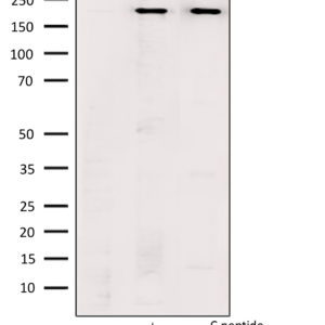 WB of mouse brain lysates stained with BRCA1-pS1524 Rabbit Polyclonal Antibody AE00298