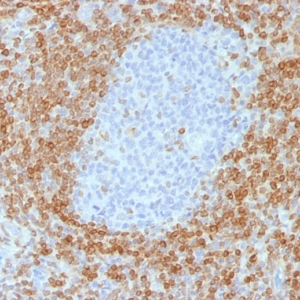 IHC of human tonsil stained with BCL-2/BCL2 Mouse Recombinant Monoclonal Antibody AE00103