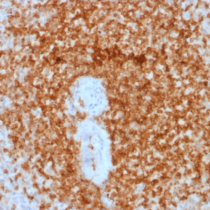IHC of human spleen stained with BCL-2/BCL2 Mouse Recombinant Antibody AE00104