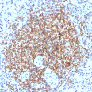 IHC of human spleen stained with BCL-2/BCL2 Rabbit Recombinant Monoclonal Antibody AE00105