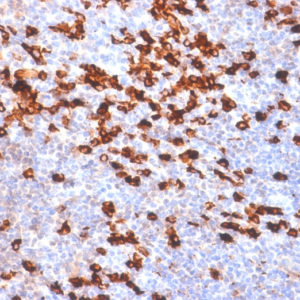 IHC of human tonsil stained with IGKC Rabbit Recombinant Monoclonal Antibody AE00116