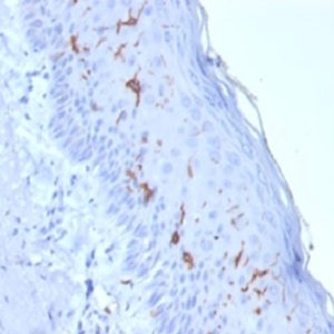 IHC of human skin stained with CD1a Mouse Recombinant Monoclonal Antibody AE00128