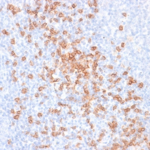 IHC of human tonsil stained with CD8a Mouse Recombinant Monoclonal Antibody AE00129