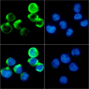 ICC of Jurkat stained with CD137 Rabbit Recombinant Antibody AE00311