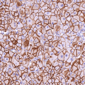 IHC of human oncocytoma stained with CDH16 Rabbit Recombinant Antibody AE00345