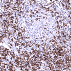 IHC of human lymph node stained with CD5 Rabbit Recombinant Antibody AE00351