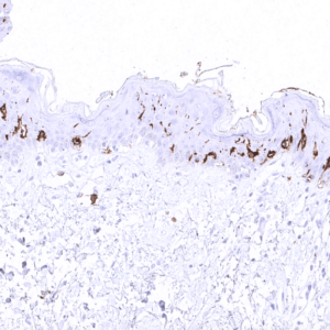 IHC of human skin stained with CD1a Mouse Recombinant Antibody AE00348