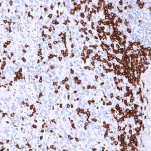 IHC of human spleen stained with CD3e Rabbit Recombinant Antibody AE00349