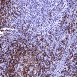 IHC of human lymph node stained with CD22 Rabbit Recombinant Antibody AE00354