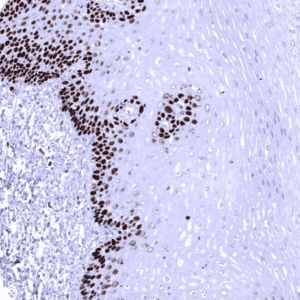 IHC of human esophagus stained with MCM7 Rabbit Recombinant Antibody AE00374